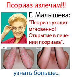 Лечение псориаза и других кожных болезней
