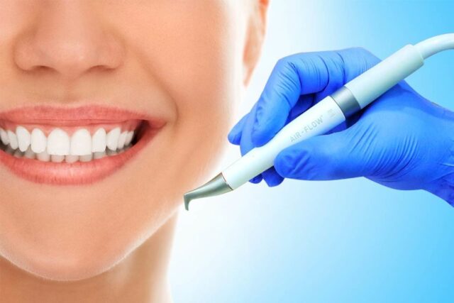 Профессиональная чистка зубов в стоматологии: главные показания, используемые методы