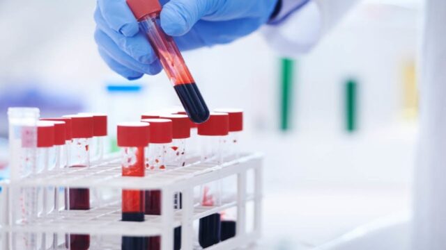 Какие анализы сдать на железо: полный список тестов для выявления скрытого дефицита и анемии