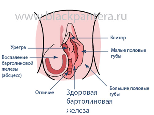 Бартолинит