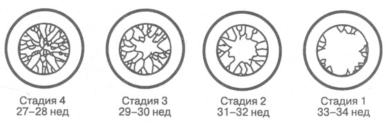 Гестационный возраст плода