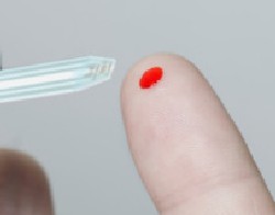 Как после выведения больного из диабетического кетоацидоза осуществляется перевод его на пролонгированные инсулины? Как после выведения больного из диабетического кетоацидоза осуществляется перевод его на пролонгированные инсулины?