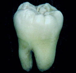 Будущее стоматологии за искусственно выращенными зубами