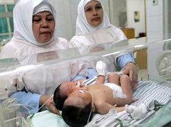 Здоровый двухголовый младенец появился на свет в Бразилии