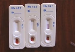 Американские медики вылечили 9-месячного ребенка от ВИЧ
