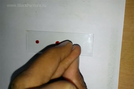 Анализ крови поможет ограничить использование антибиотиков при пневмонии Анализ крови поможет ограничить использование антибиотиков при пневмонии