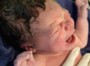Медицинских показаний к обрезанию пока не существует Медицинских показаний к обрезанию пока не существует