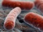 Ученые доказали эффективность витамина С при лечении туберкулеза Ученые доказали эффективность витамина С при лечении туберкулеза