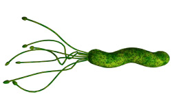 Бактерия Helicobacter Pylori стала менее опасной Бактерия Helicobacter Pylori стала менее опасной