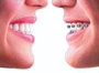     Invisalign